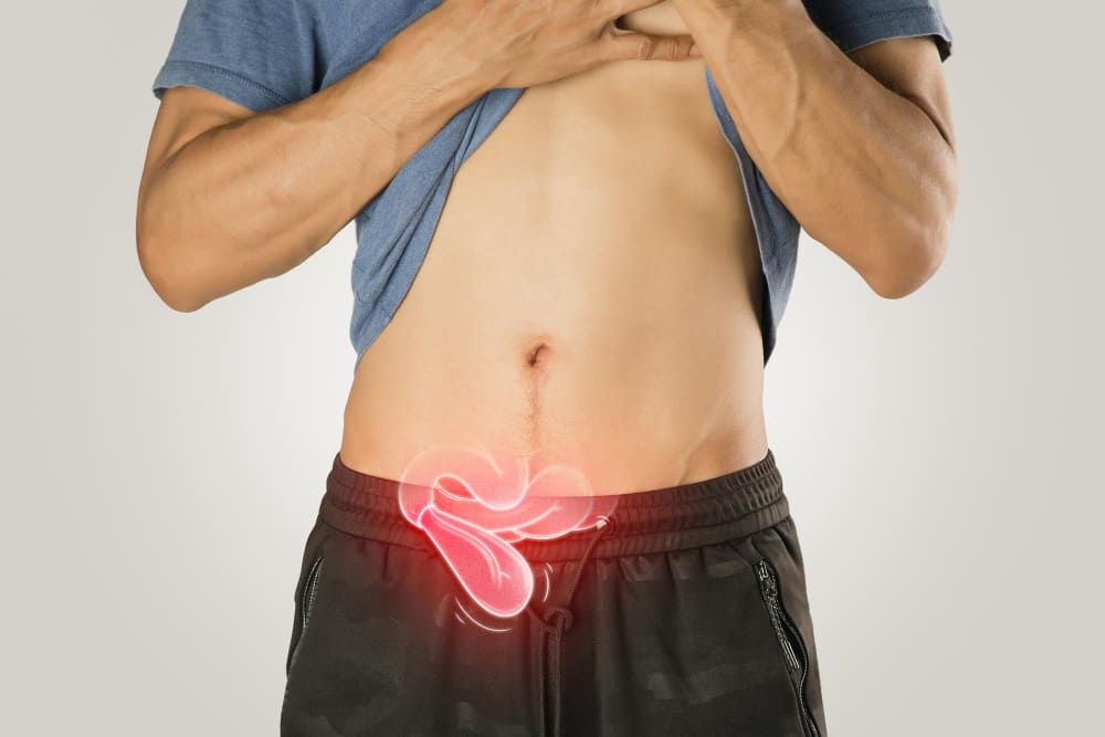 Apendicitis aguda